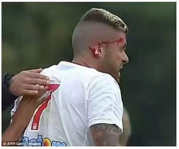 Photos: Footballer Jeremy Menez Has His Ear Ripped Off In Freak Tackle During Friendly Match